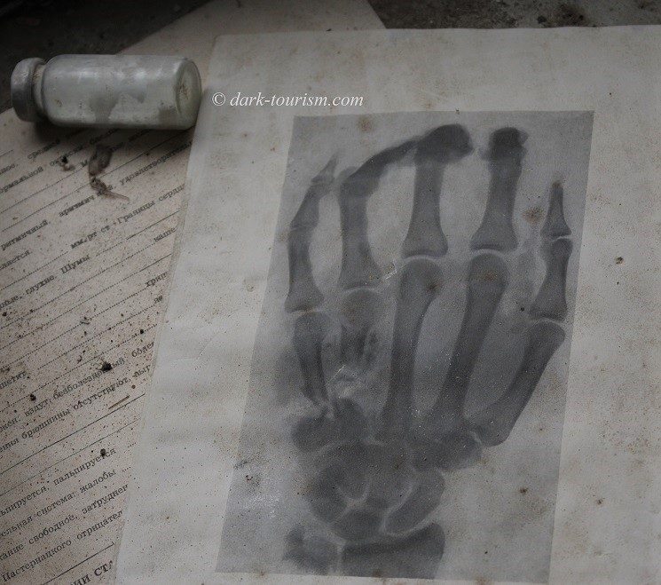 01 - hand X-ray, Pripyat hospital